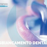 Sbiancamento dentale a led | News | Studio Bordini Quadrelli